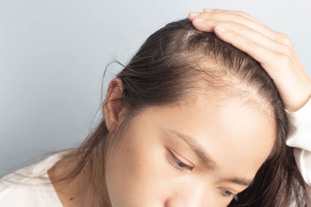 What is the Psychological Impact of Hair Loss? – And How Hair Replacement Can Help