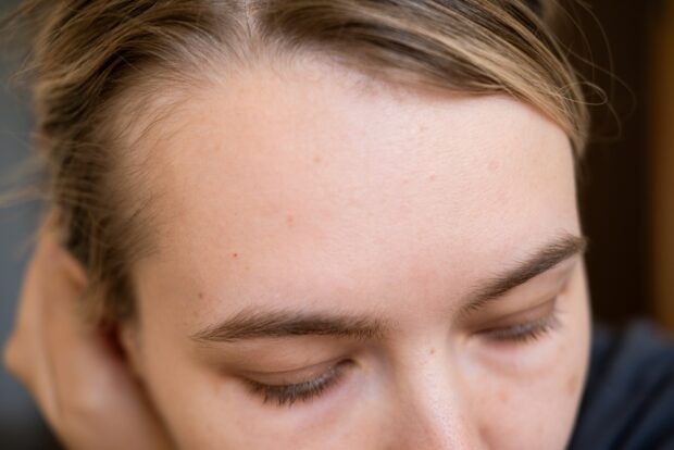 Why Greensboro Residents Choose Raveen for Hair Replacement Services