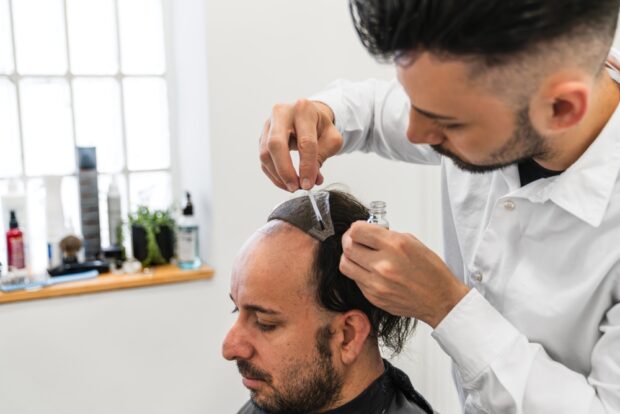 How Long Do Hair Replacement Systems Last? Maintenance Tips Inside