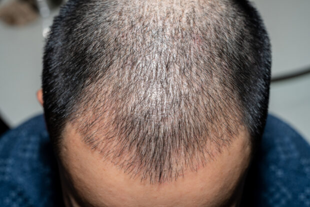 The Science Behind Natural Hair-by-Hair Reconstruction