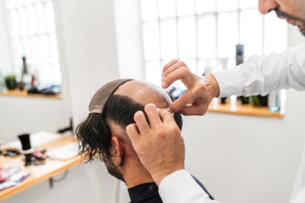 Non-Surgical Hair Replacement: The Safe, Natural Alternative to Surgery