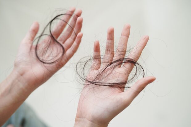 Hair Systems for Women: Addressing Thinning, Medical Hair Loss, and Confidence Concerns
