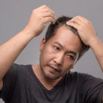 Asian,Man,With,Hair,Loss,Problem,Receiving,Serum,Treatment,Hair