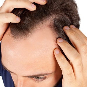 Raveen Hair Replacement Hair Loss Treatment in Greensboro NC